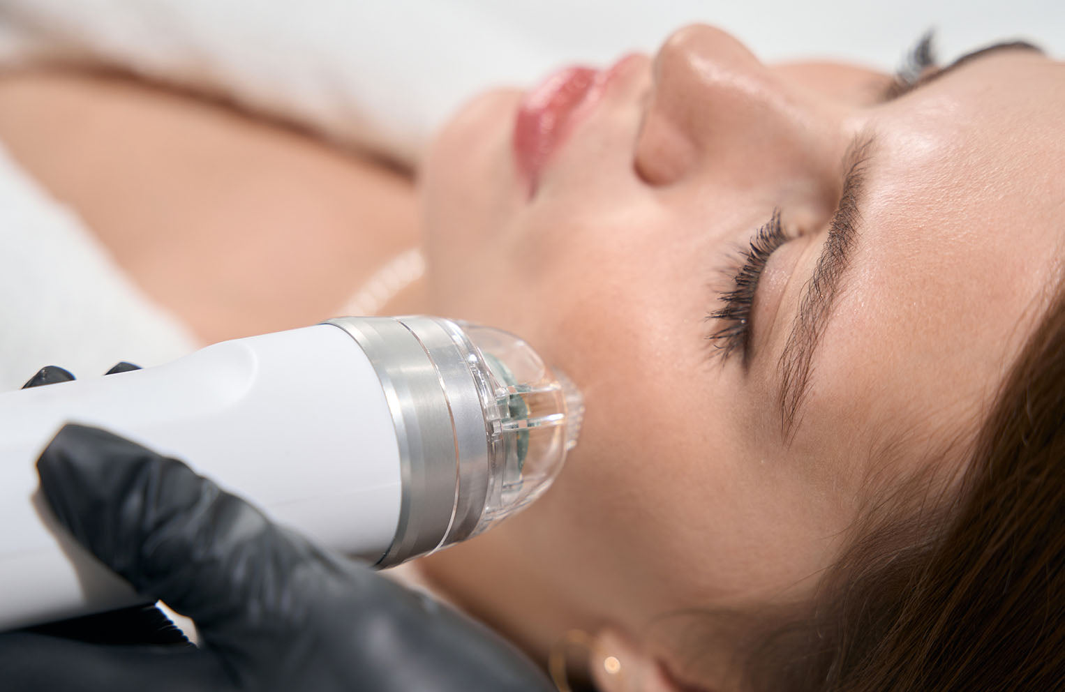 model laying down receiving laser skincare treatment