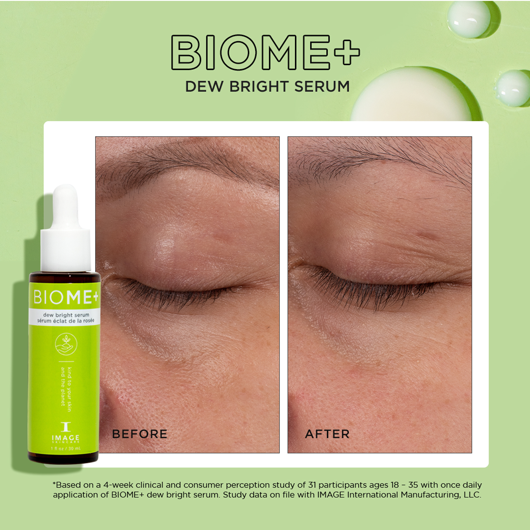 BIOME+ dew bright serum before and after shots of model closed eye area showing results after 4 weeks
