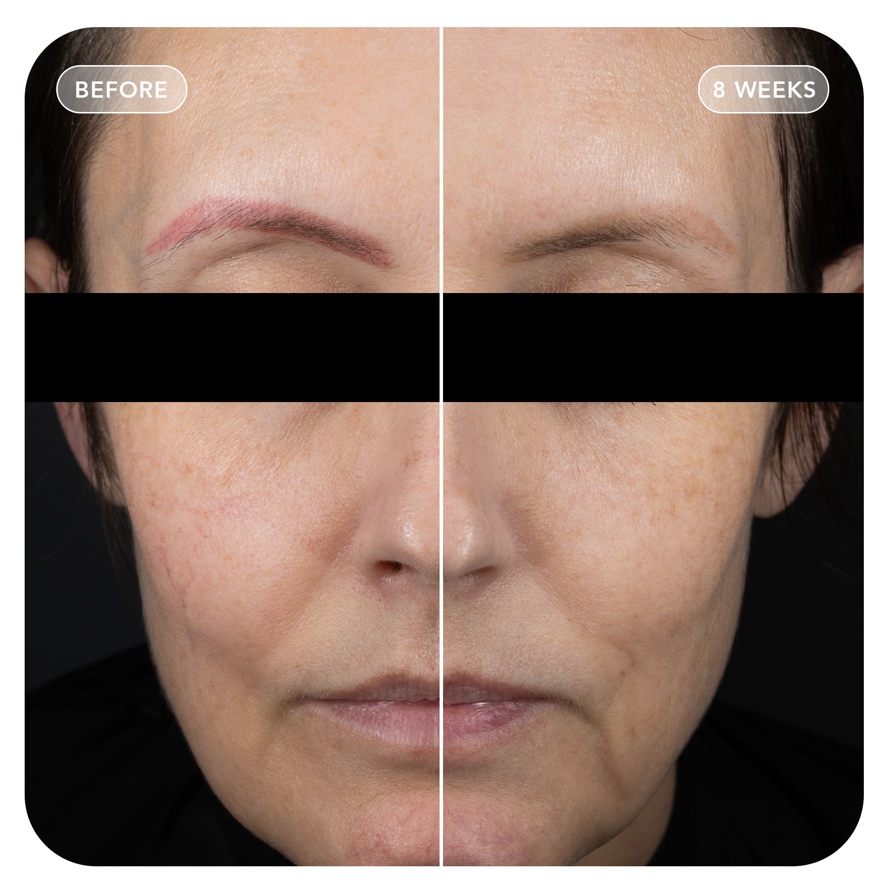 VOL.U.LIFT™ GLP-1 4D Skin Rebound Complex
