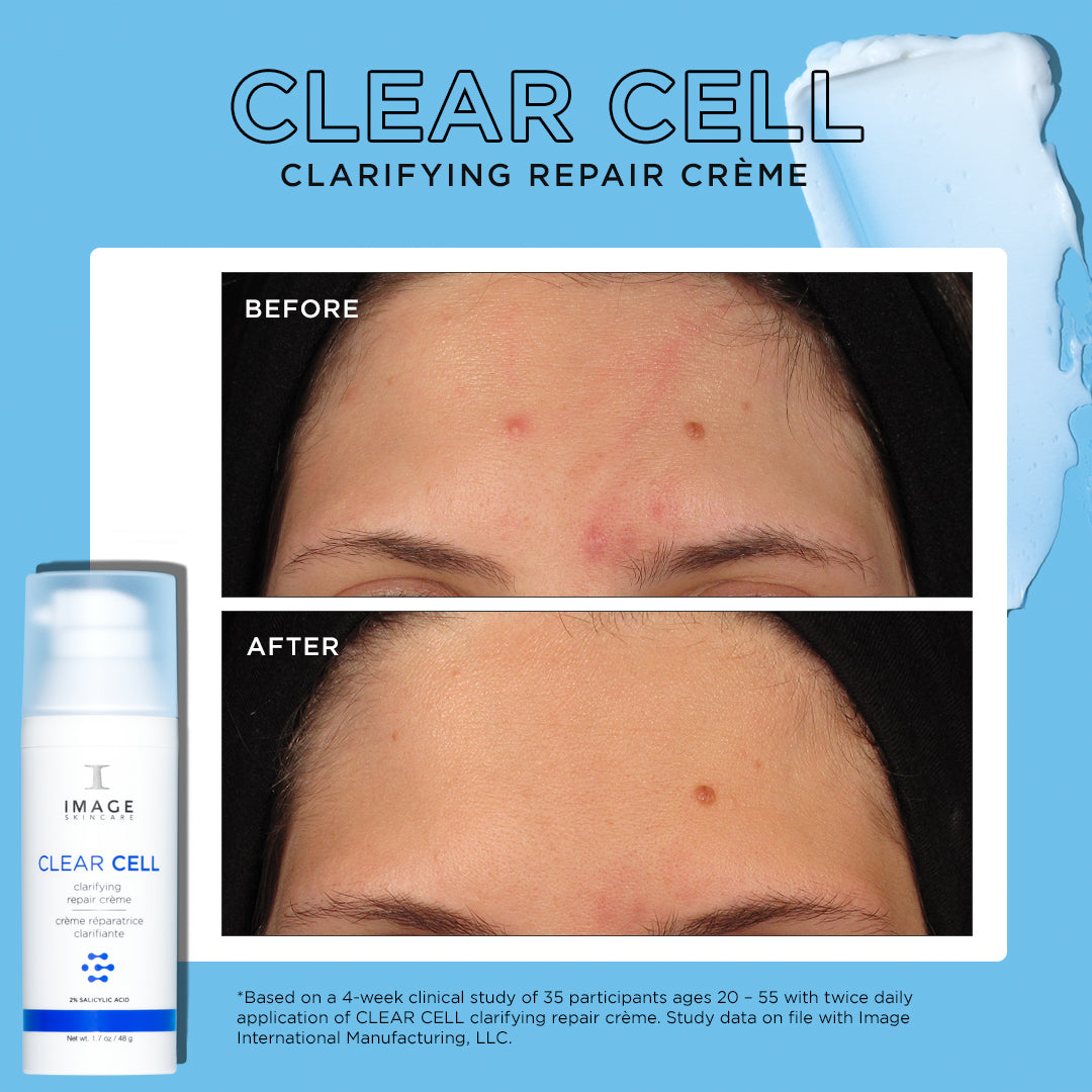 CLEAR CELL clarifying repair crème before and after