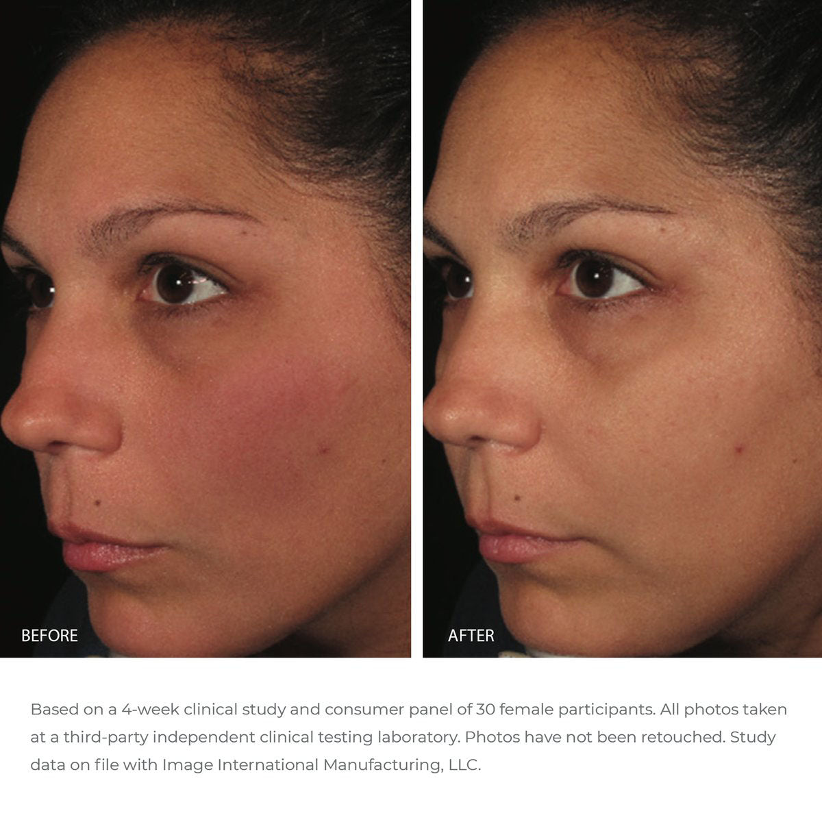 Before and after pictures of the results of the ORMEDIC antioxidant serum.