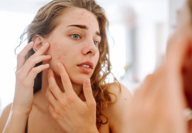 Eczema Skincare Routine: A Dermatologist-Approved Regimen for Sensitive Skin