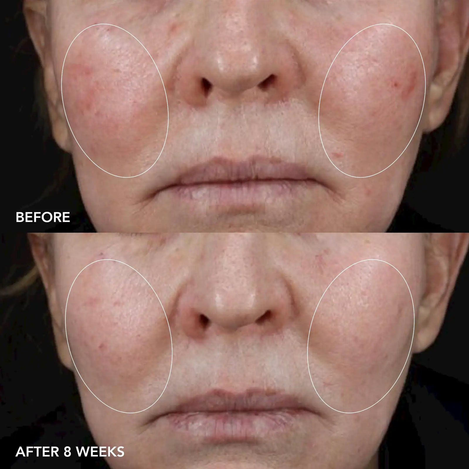 IMAGE MD® biotech longevity creme