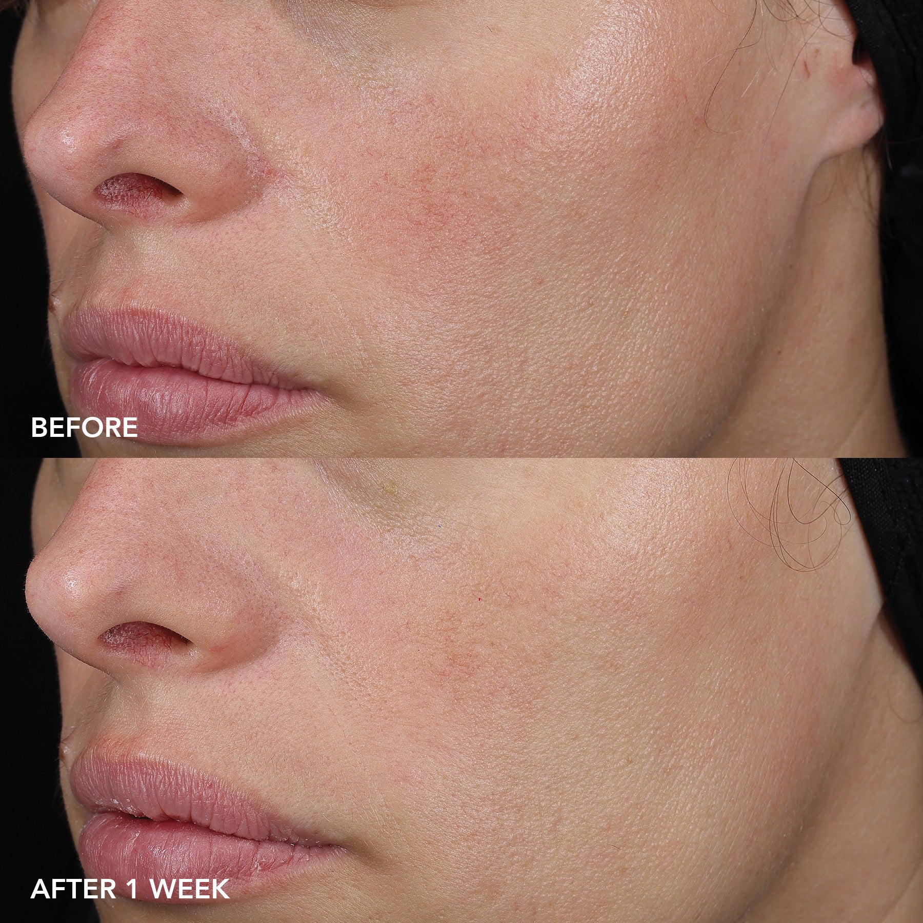 Skin Barrier Repair Recovery Balm | IMAGE MD