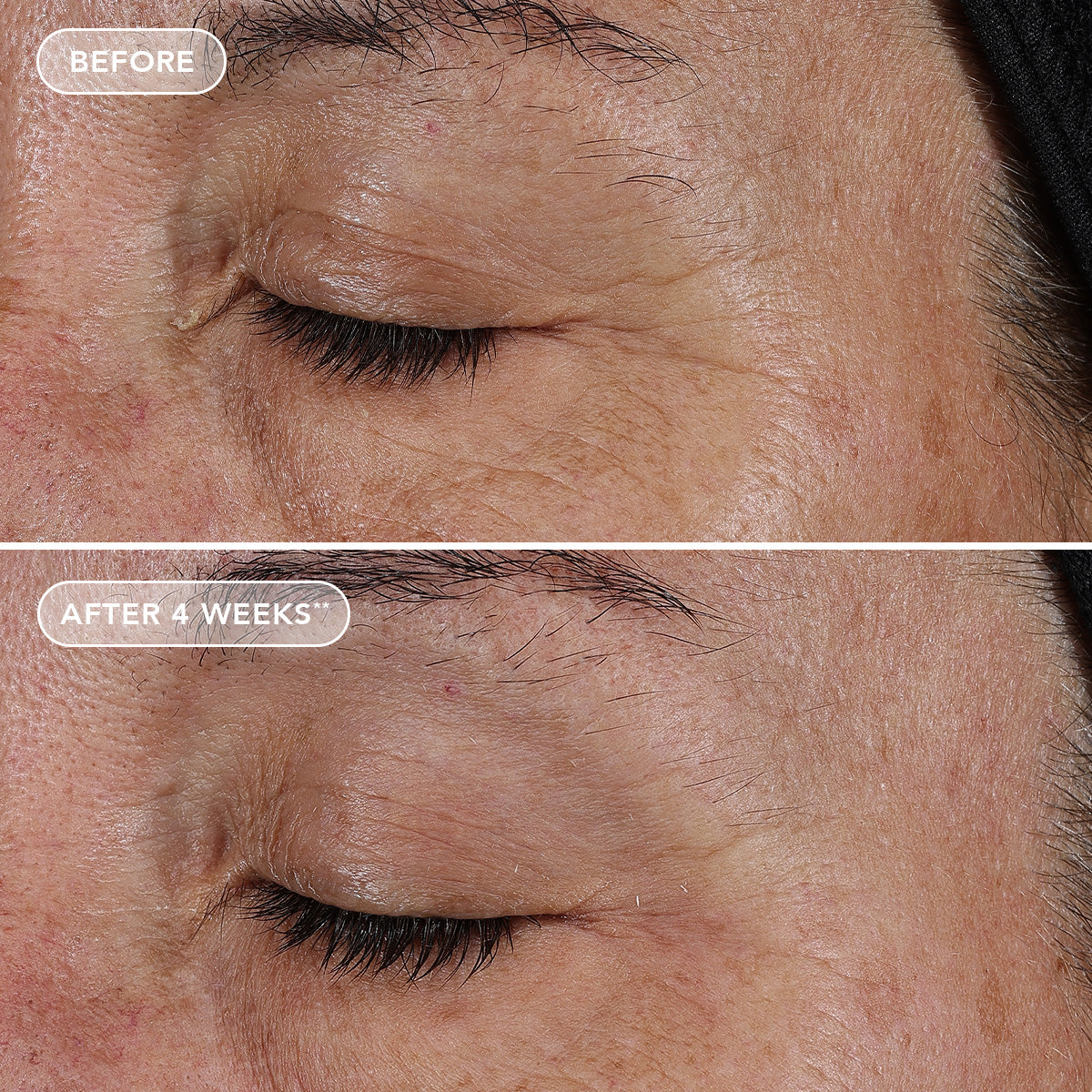 AGELESS+ retinol pure liquid retinol 0.1%