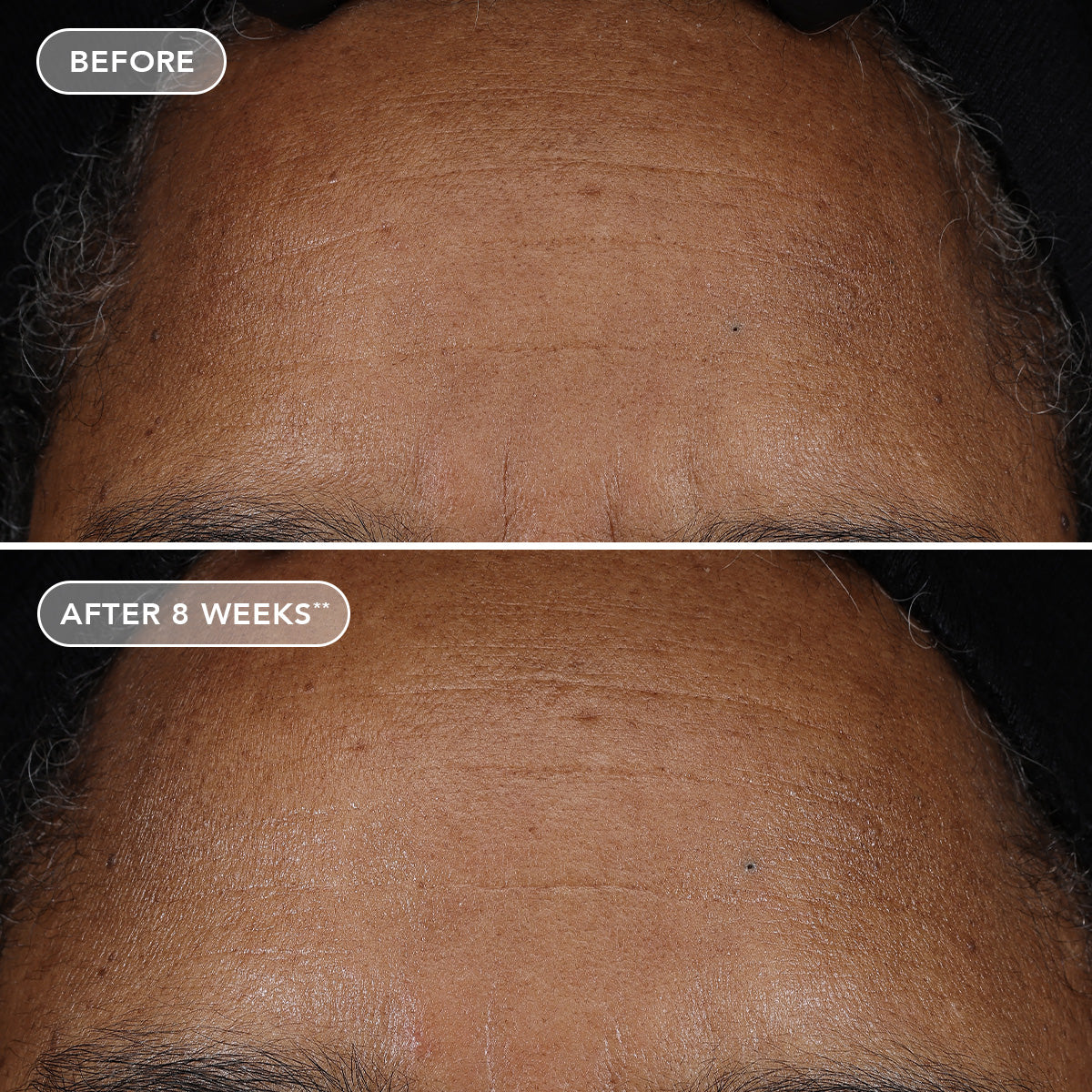 AGELESS+ retinol pure liquid retinol 0.75%