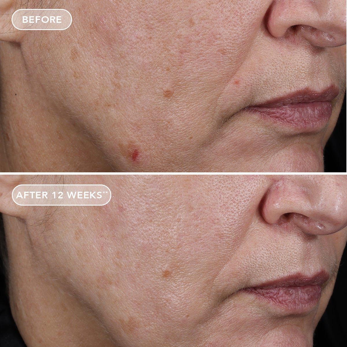 AGELESS+ retinol pure liquid retinol 0.75%