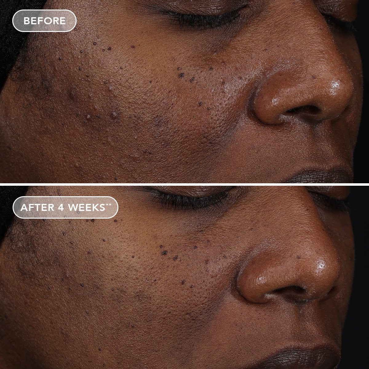 AGELESS+ retinol repair crème 0.3% retinol complex