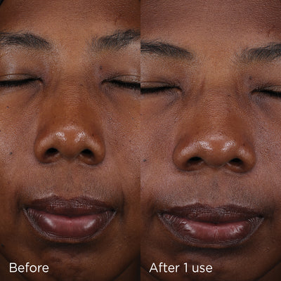 Close-up comparison of skin appearance before and after one use of IMAGE Skincare Daily Prevention Pure Mineral Tinted Moisturizer SPF 30, highlighting improved complexion and hydration.