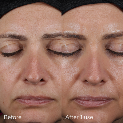 before and after one use