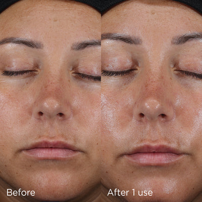 Before and after comparison of using IMAGE Skincare Daily Prevention Ultra Defense Moisturizer with SPF 50, showing improved skin radiance and texture.