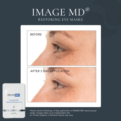 before and after shot of model profile showing results after 5 days