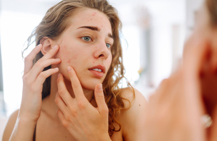 Eczema Skincare Routine: A Dermatologist-Approved Regimen for Sensitive Skin