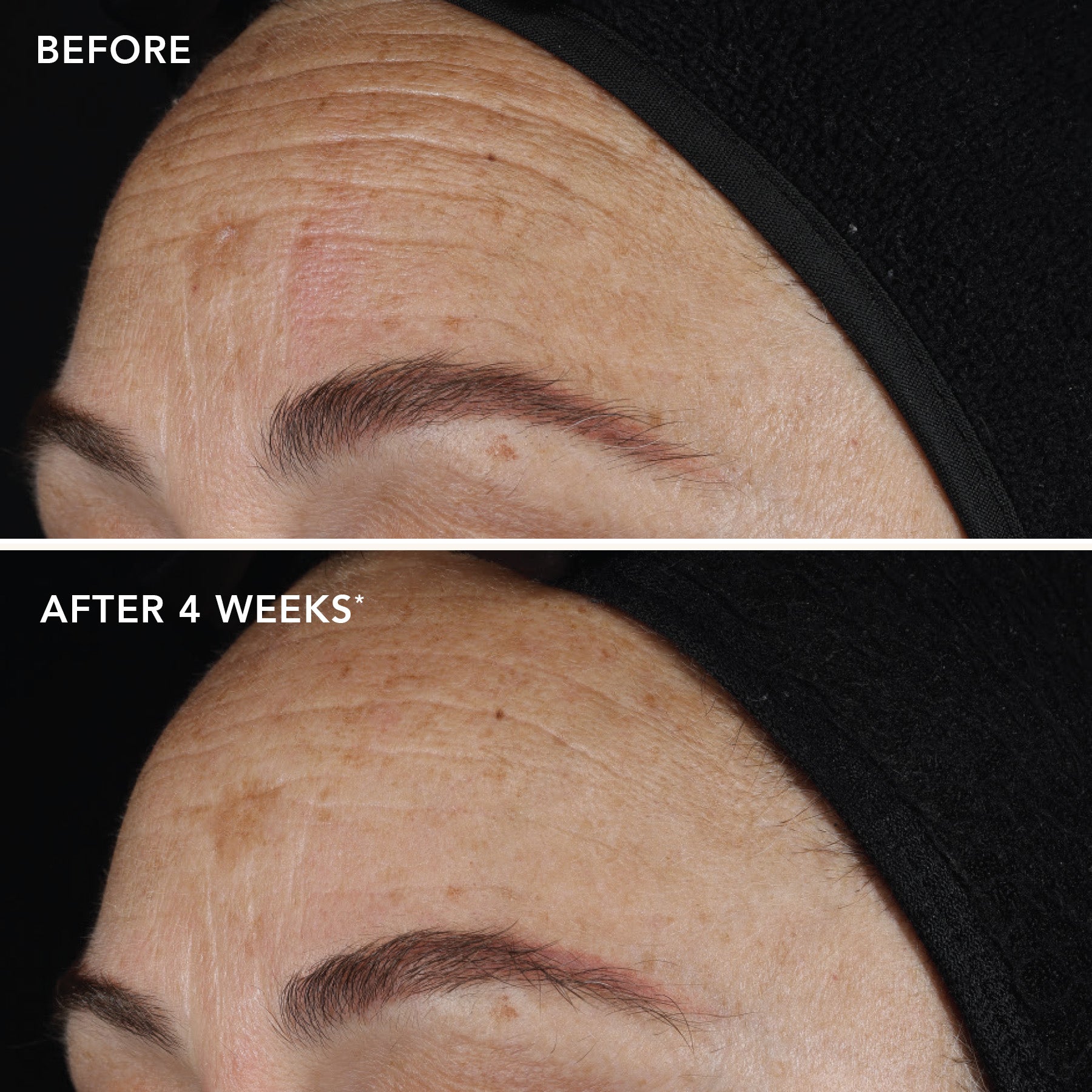 AGELESS+ retinol pure liquid retinol 0.1% (travel size)