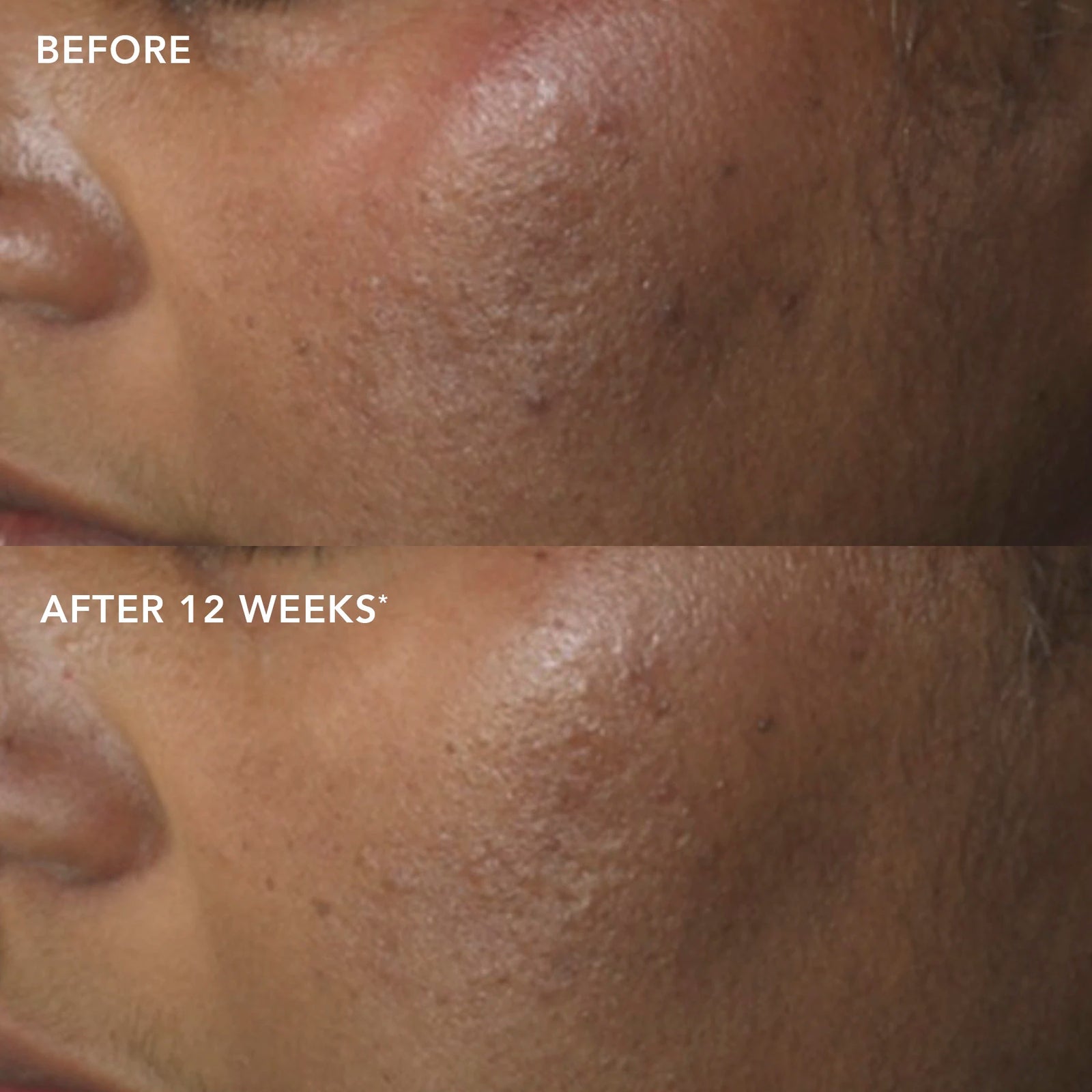 IMAGE MD® restoring power-C serum