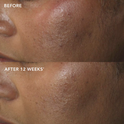 IMAGE MD® restoring power-C serum