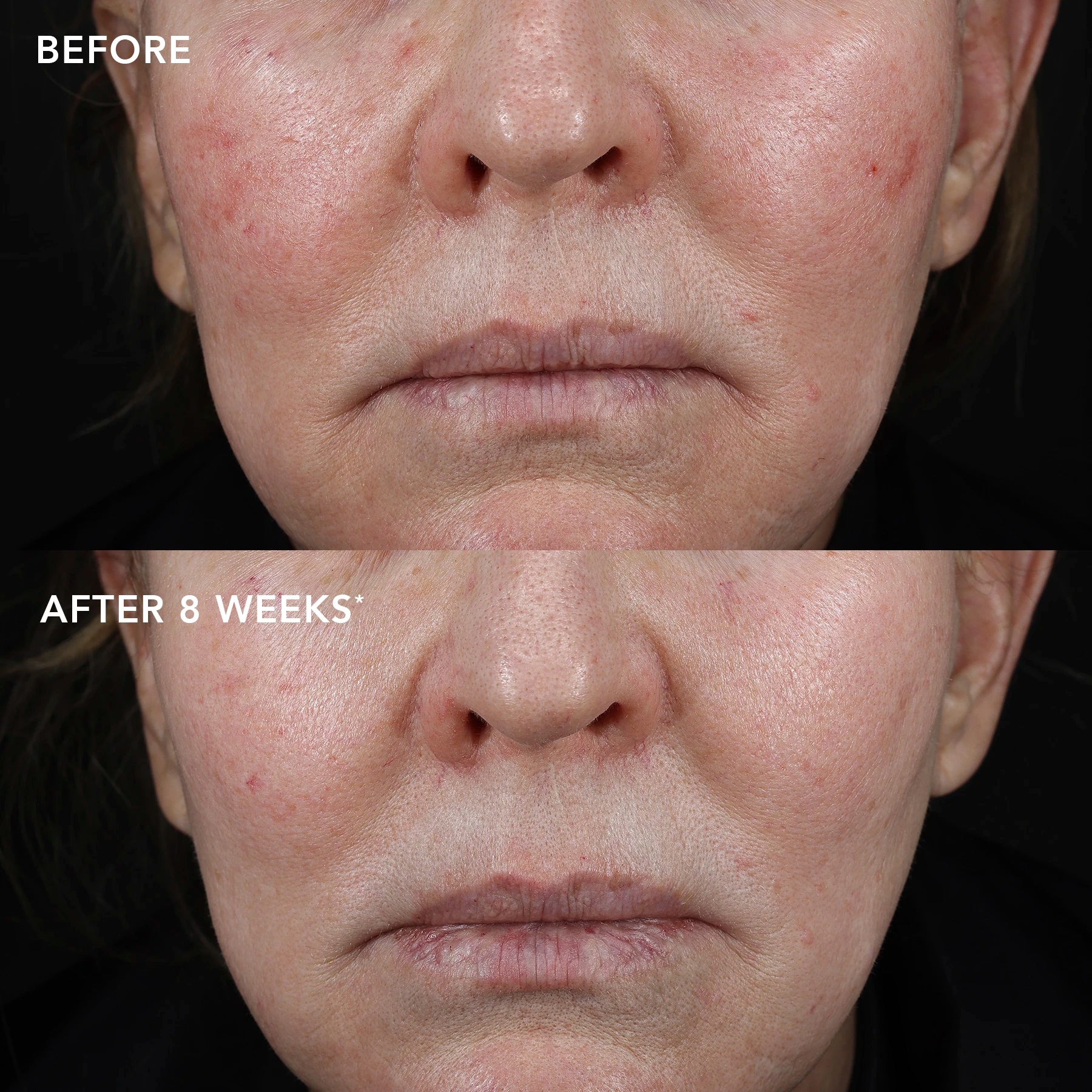 IMAGE MD® biotech longevity creme