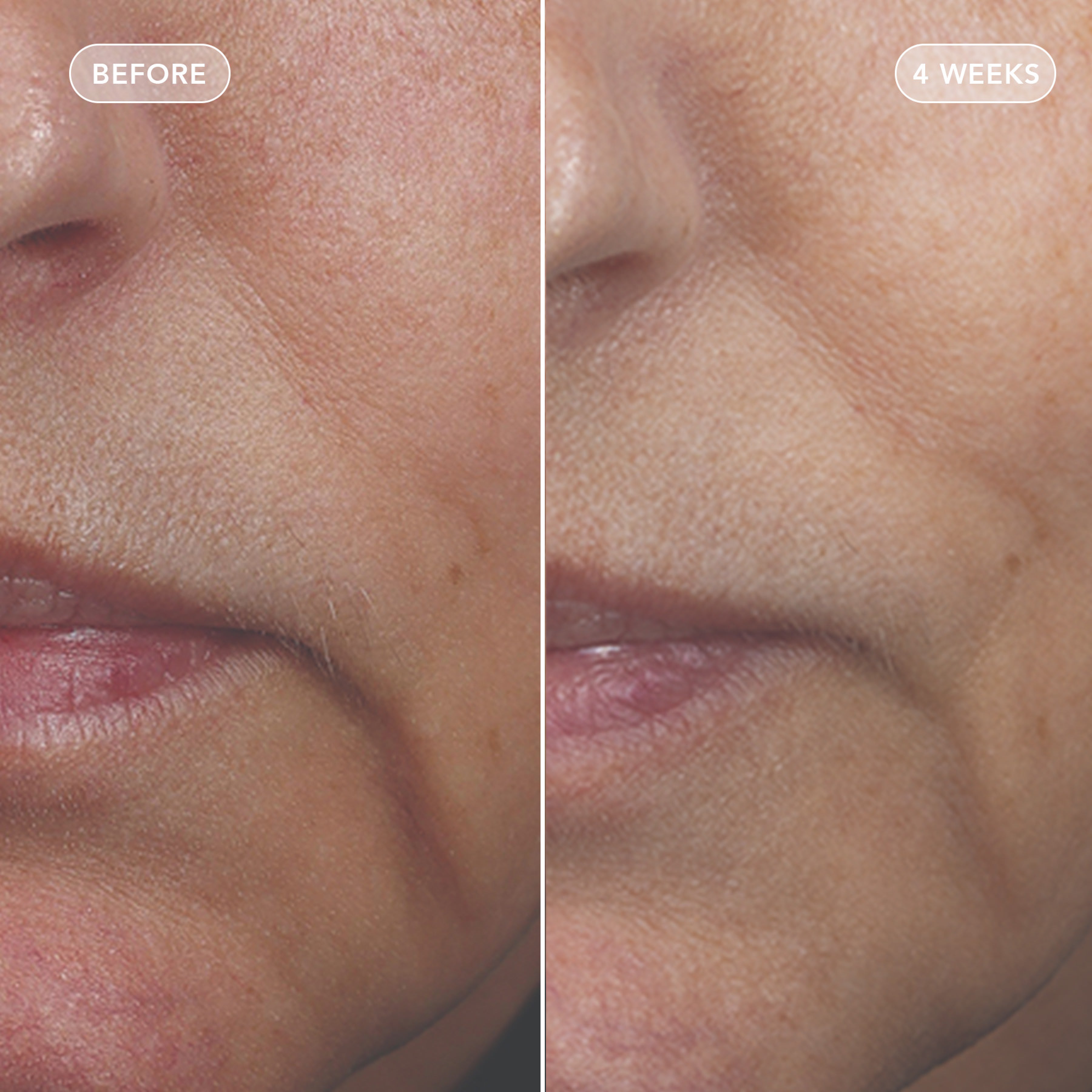 VOL.U.LIFTโข GLP-1 4D Skin Rebound Complex