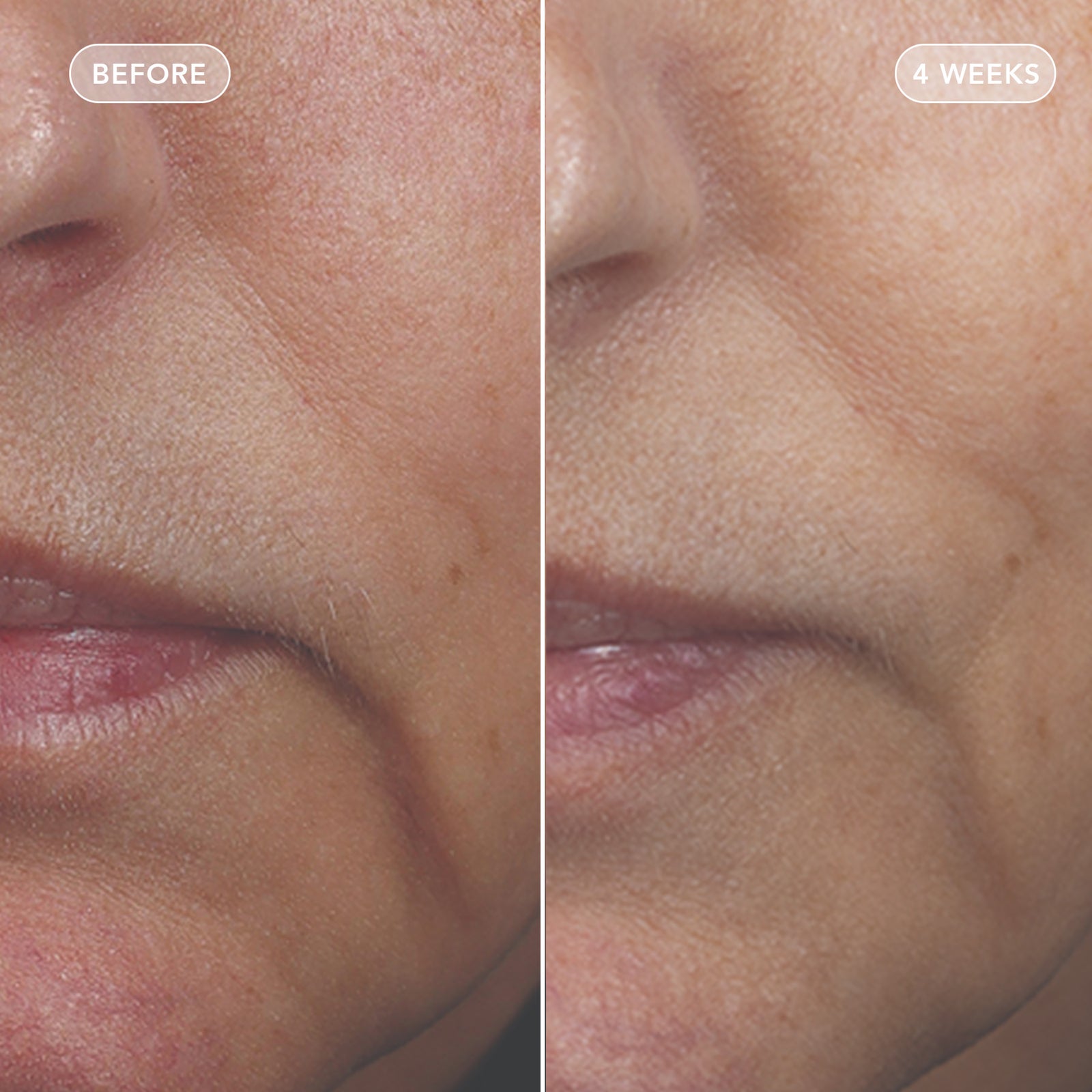 VOL.U.LIFT™ GLP-1 4D skin rebound complex