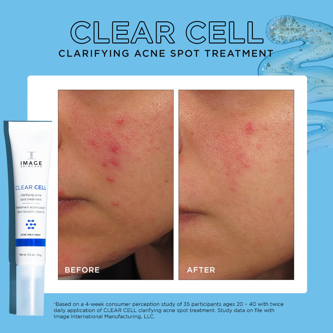 Before and after skin comparison using the CLEAR CELL clarifying acne spot treatment