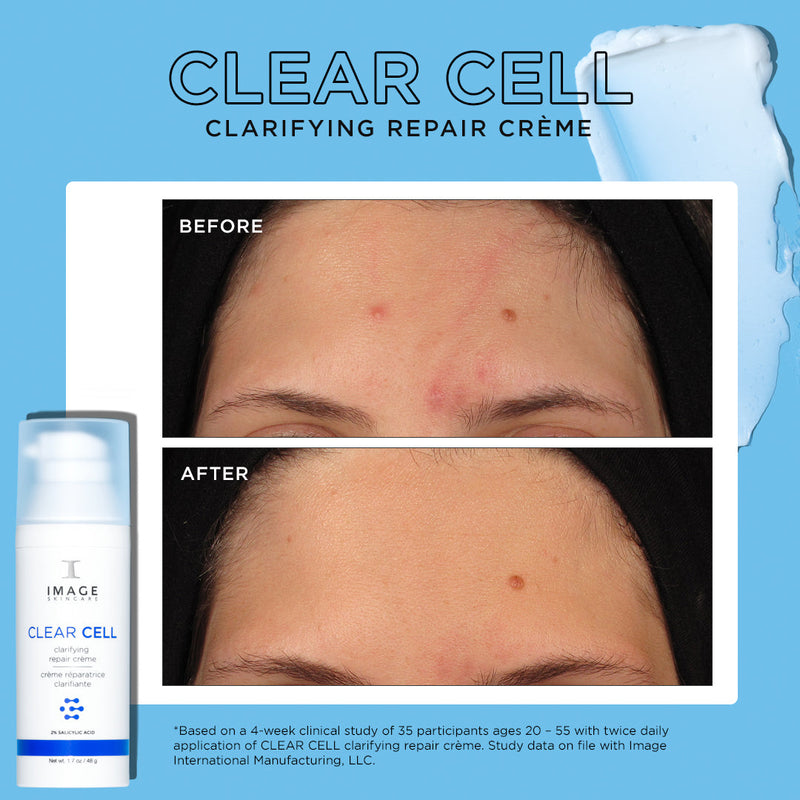 CLEAR CELL clarifying repair crème before and after