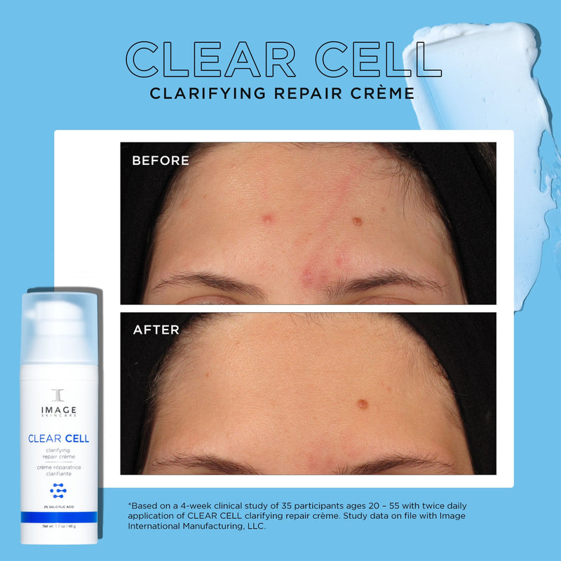 Discovery-size CLEAR CELL clarifying repair crème mini before and after