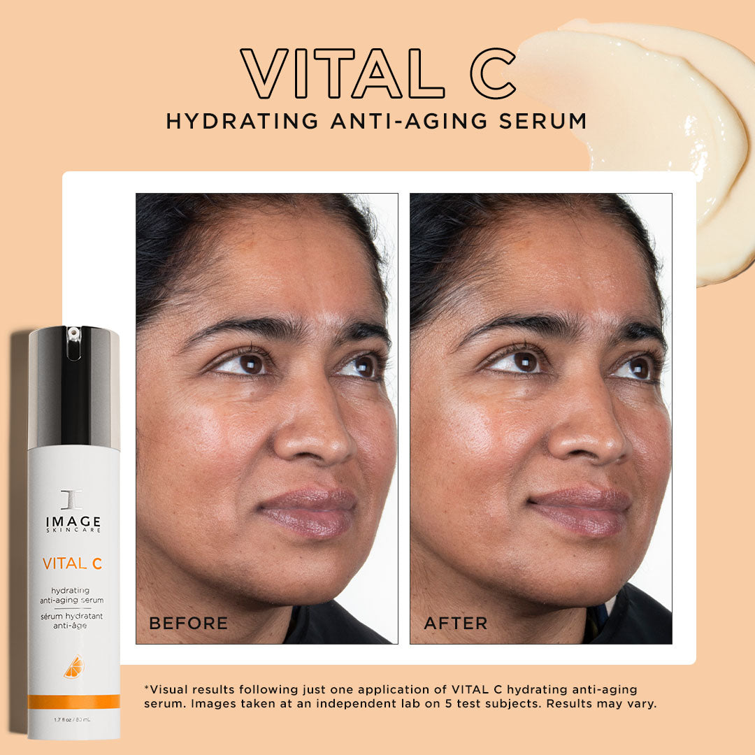 Before and after pictures of the power of using a vitamin C serum.
