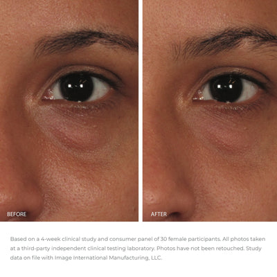 close up of model half face showing under eye results after 4 weeks of use